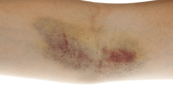 categorie Bobos & Co image