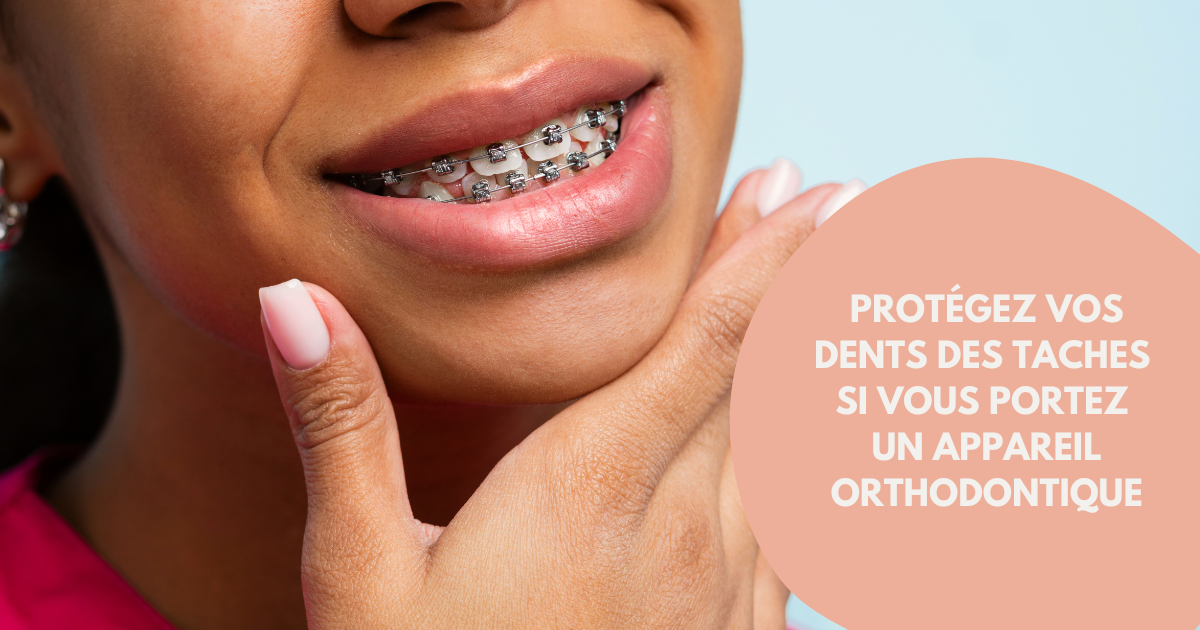 Appareil dentaire : 10 conseils pour garder des dents blanches image