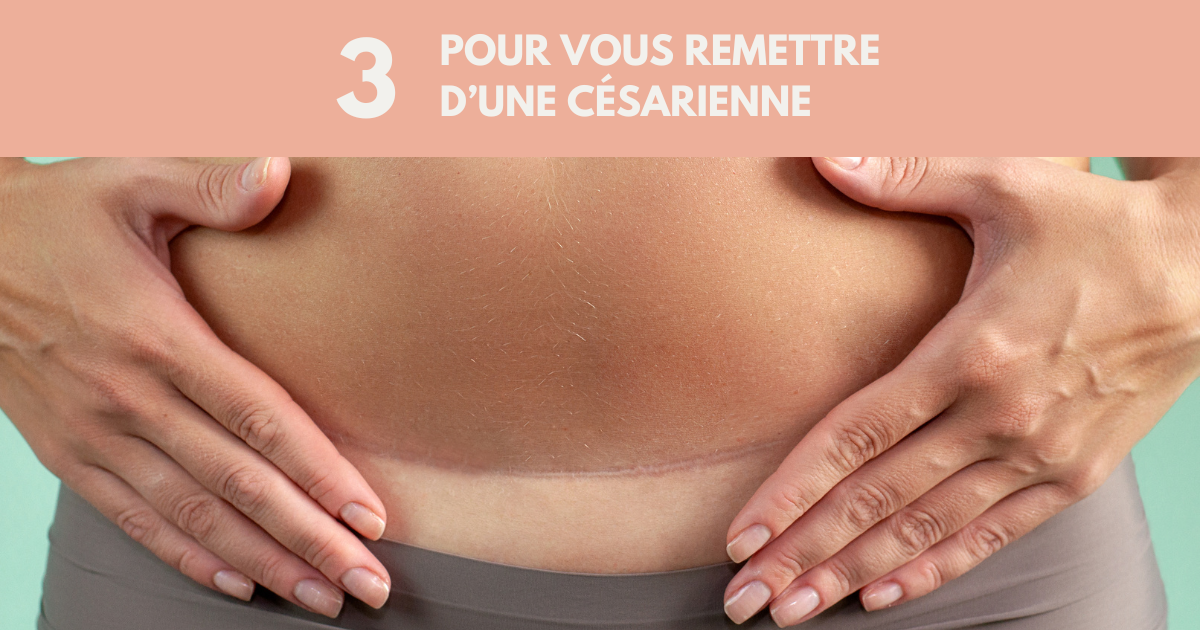 Césarienne : Les étapes pour bien cicatriser et retrouver sa mobilité image