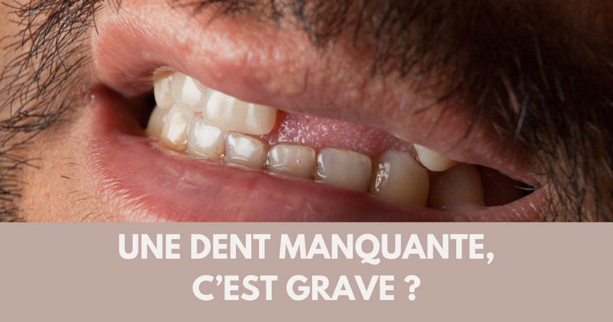 Perte dentaire : un impact bien plus large qu’un simple trou image