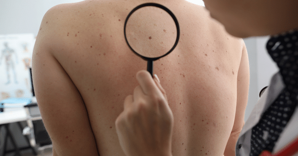 categorie Dermatologie image