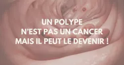 Pourquoi faut-il retirer les polypes ?