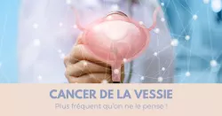 Cancer de la vessie, une maladie encore trop méconnue !