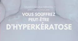 L’hyperkératose, un épaississement anormal de la peau