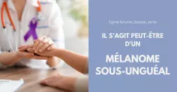 Comment reconnaître et traiter un mélanome de l’ongle ?