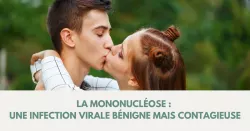 Mononucléose : quel traitement ?