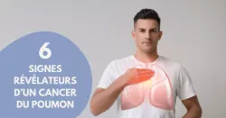 Cancer du poumon : comment le dépister ?