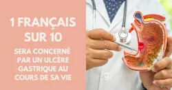 Tout savoir sur l’ulcère gastrique