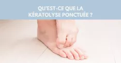 Comment traiter une kératolyse ponctuée ?