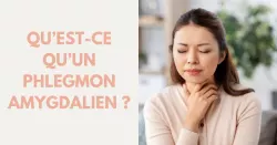 Phlegmon amygdalien : diagnostic et traitements