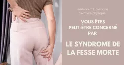 Syndrome de la fesse morte : 3 manières d’agir