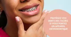 Appareil dentaire : 10 conseils pour garder des dents blanches