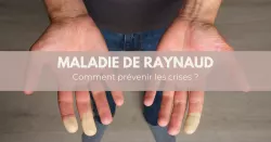 Maladie de Raynaud, quand le corps régit au froid