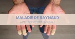 Maladie de Raynaud, quand le corps régit au froid