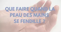 Gerçures, fissures, crevasses… des mains abîmées