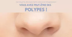 Polype nasal, les solutions pour le traiter