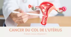 Cancer du col de l’utérus : symptômes et facteurs de risque