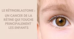 Rétinoblastome : quelle est la spécificité de ce cancer pédiatrique ?