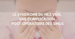Qu’est-ce que le syndrome du nez vide ?