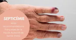 Quelle conduite à tenir face à un sepsis et comment le prévenir ?