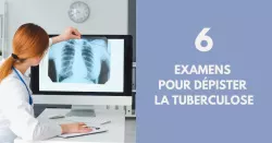 Tuberculose : savoir la diagnostiquer pour limiter sa propagation