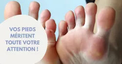 12 affections courantes pouvant fragiliser les pieds