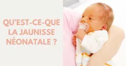 Jaunisse du nourrisson : les causes et les symptômes