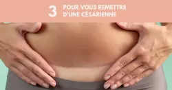 Césarienne : Les étapes pour bien cicatriser et retrouver sa mobilité
