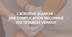 Comment traiter une atrophie blanche ?