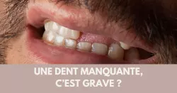 Perte dentaire : un impact bien plus large qu’un simple trou