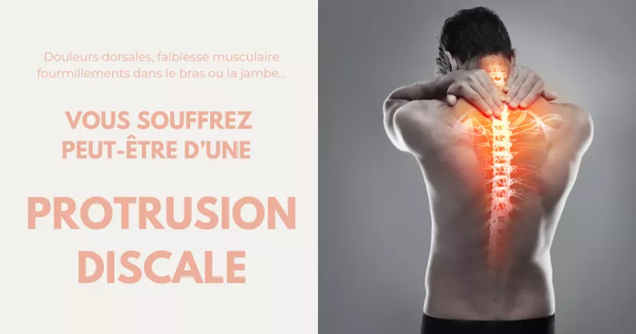 3 manières de soulager une protrusion discale