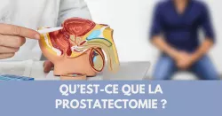 Prostatectomie, quand l’ablation de la prostate est nécessaire…