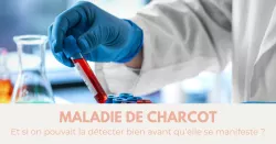 Maladie de Charcot : Un test sanguin porteur d’espoir !