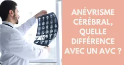 AVC ou rupture d’anévrisme : la vraie différence que tout le monde devrait connaître