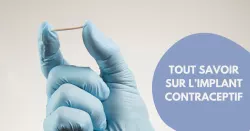 L'implant contraceptif : l'une des méthodes de contraception les plus efficaces