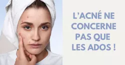Acné adulte : comprendre et agir