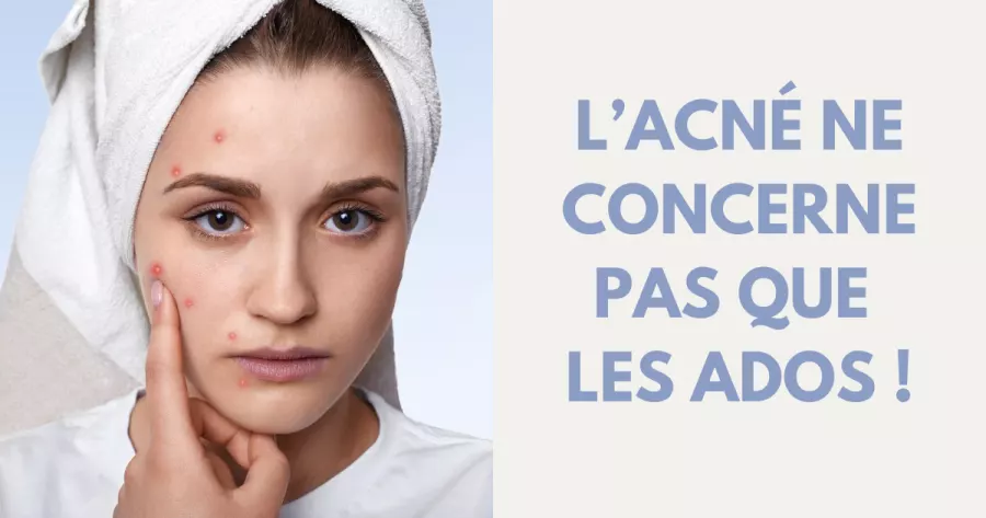 Acné adulte : comprendre et agir
