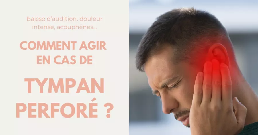 Tympan percé : causes, symptômes et traitement